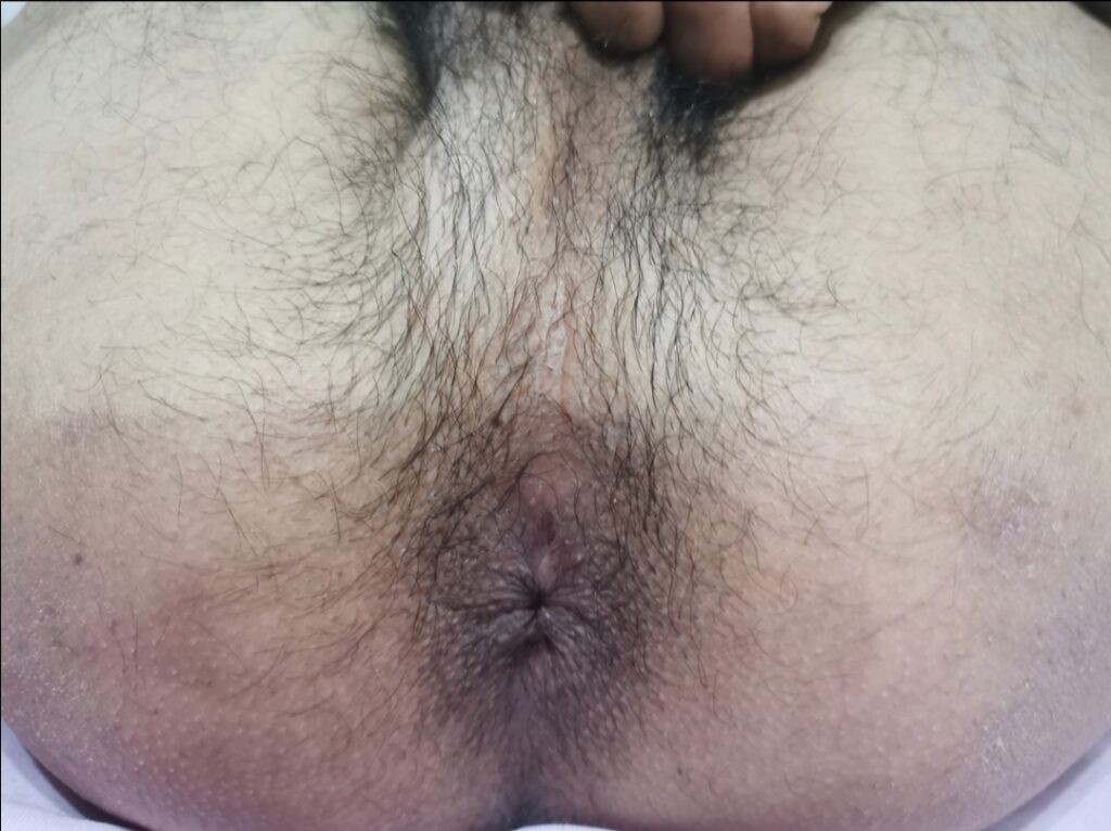 My Hot Asshole